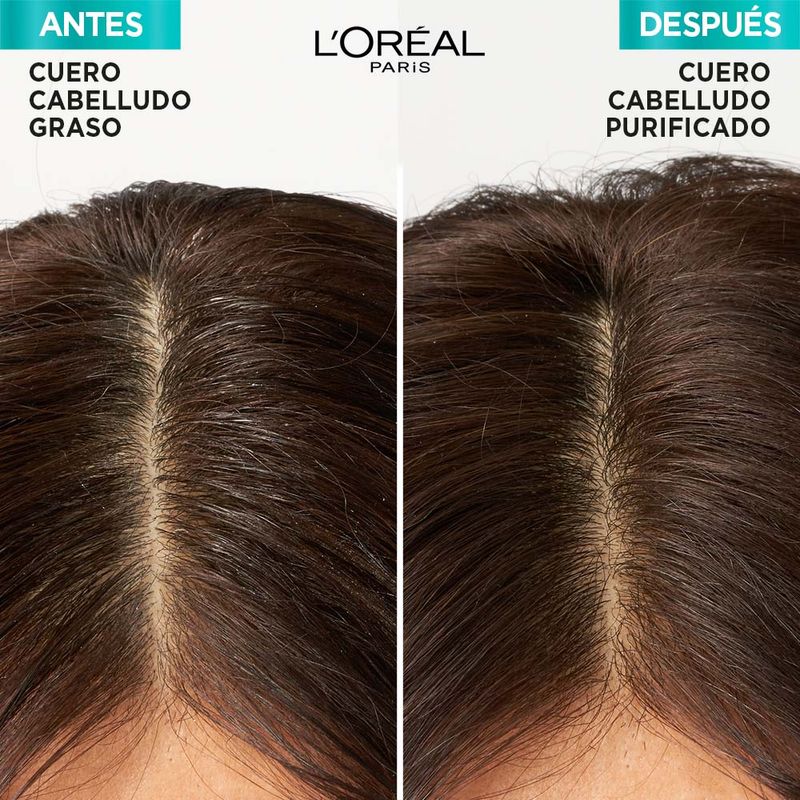 234693_combo-loreal-paris-elvive-hialuronico-pure-acondicionador-x-400-ml-shampoo-x-400-ml-mascarilla-capilar-x-300-g_Imagen-7.jpg.jpg
