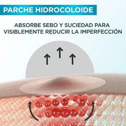 Parches Anti Imperfecciones Garnier Pimple Patch x 22 un