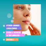 gel-secante-dermaglos-acne-control-x-15-g